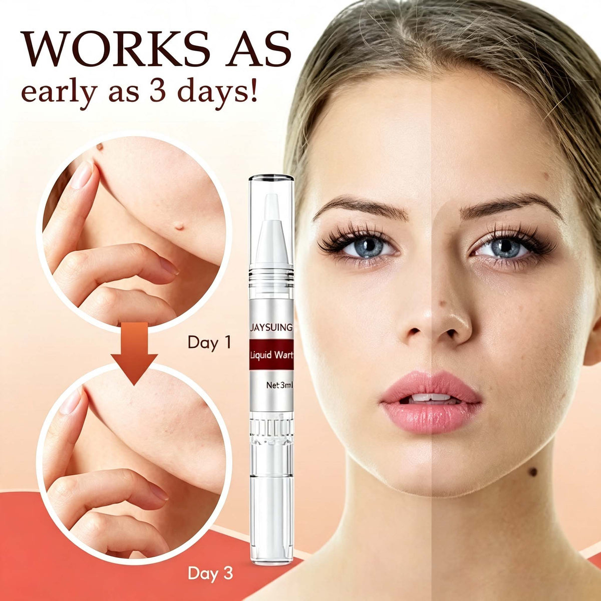 LAST DAY 49% OFF Tags & Moles Remover
