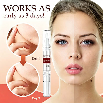 LAST DAY 49% OFF Tags & Moles Remover